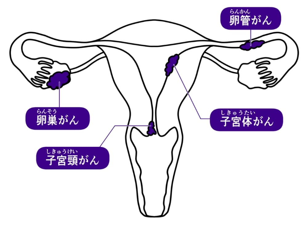 子宮イラスト